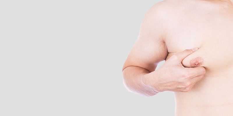 La liposuccion de la poitrine masculine permet de traiter la gynécomastie