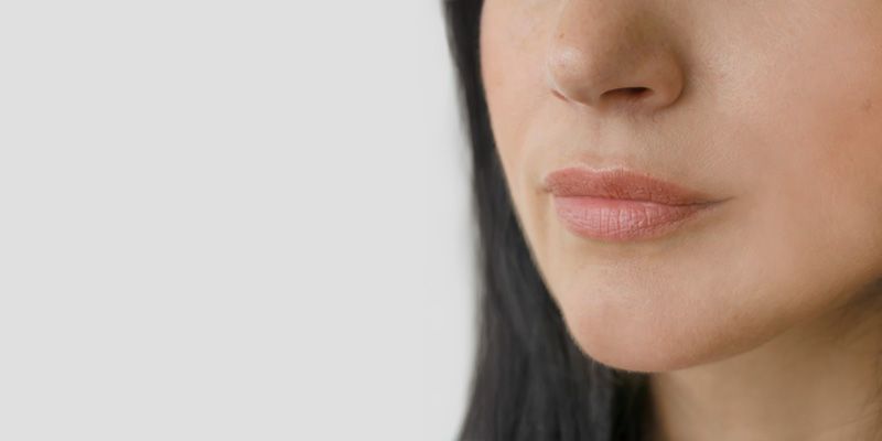 pli-amertume-injections-acide-hyaluronique