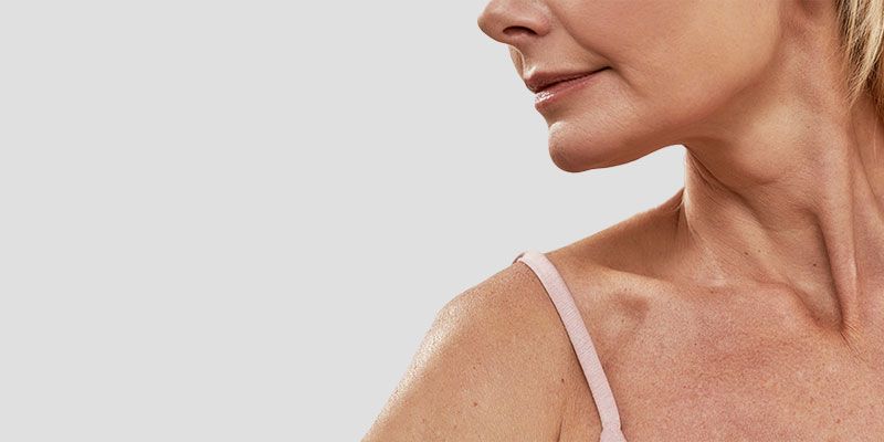 Le lifting du cou permet de corriger les asymétries