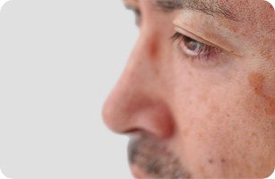 Tâches de vieillesse sur le visage