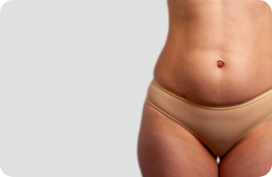 Bourrelets et formes disgracieuses sur le corps