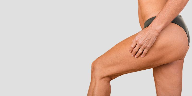 La liposuccion des cuisses permet d'équilibrer les proportions corporelles pour une amélioration générale de l'apparence