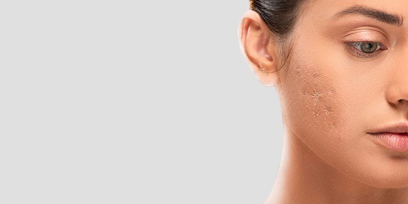 Le traitement photomodulation LED accélère et optimise la régénération des tissus