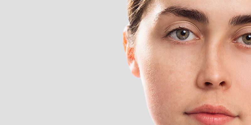 Une rhinoplastie peut être appliquée pour une correction de l'asymétrie nasale