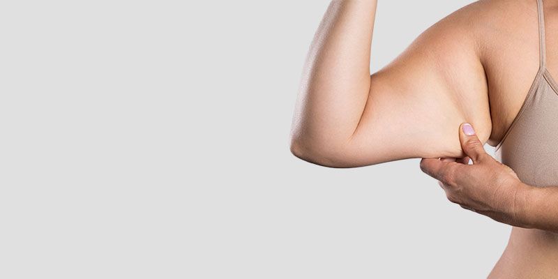 Le lifting des bras associé à la liposuccion permet un affinement général du bras
