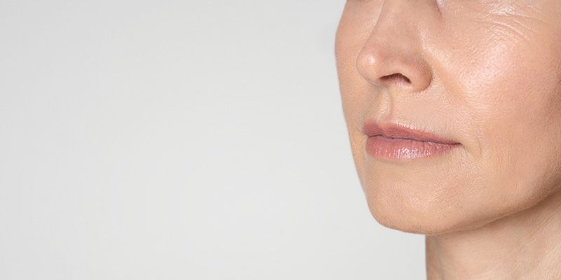 Microneedling avec radiofréquence (Virtue RF)