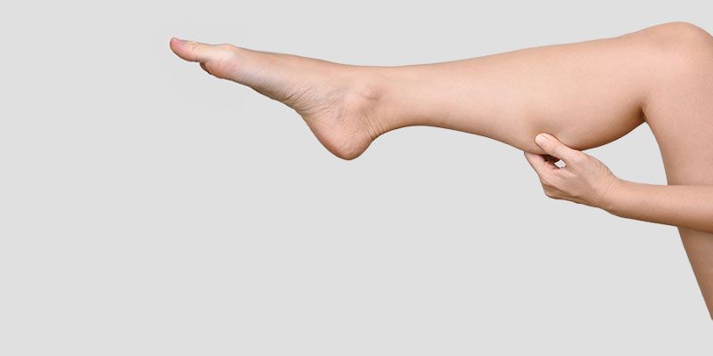 La liposuccion des genoux et mollets permet d'améliorer l’apparence des jambes
