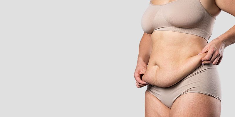 Les excès de peau sont fréquents après une perte de poids significative ou une grossesse.