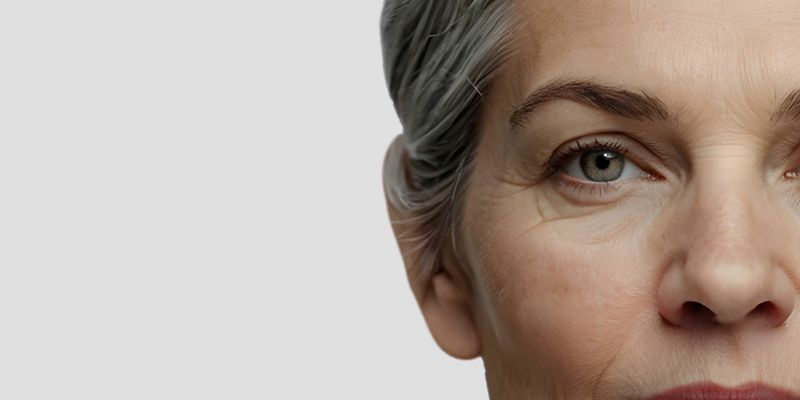 blepharoplastie