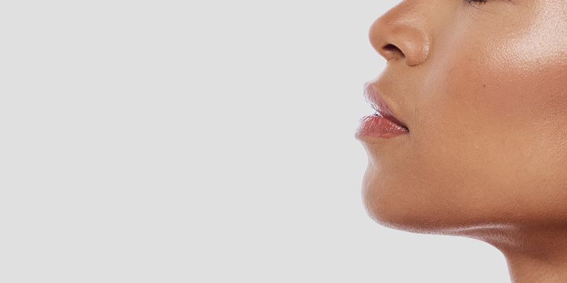 Fils tenseurs résorbables : effet liftant immédiat