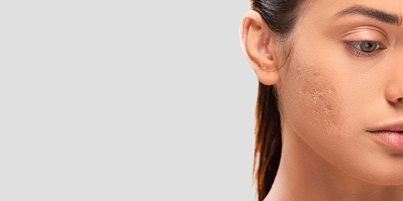 Le traitement photomodulation LED accélère et optimise la régénération des tissus