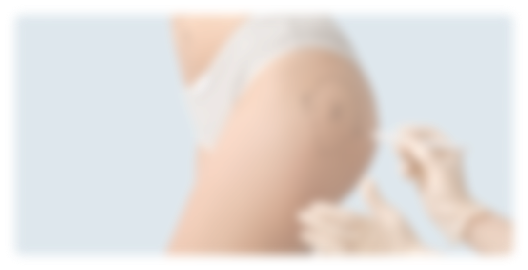 Implants fessiers