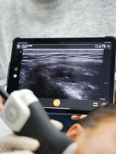 Injection d'acide hyaluronique sous echodoppler