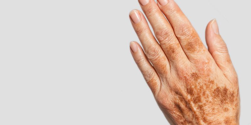 Tâches importantes ou profondes sur les mains