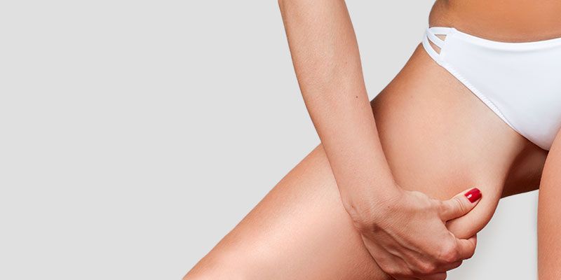 Le lifting médial est conçu pour cibler spécifiquement le relâchement cutané situé à l’intérieur des cuisses.