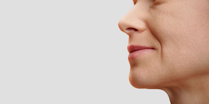 Le lifting cervico facial traite les plis profonds du visage, comme les plis naso-géniens