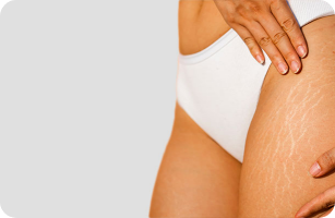 Zoom sur les rides et ridules d'une femme