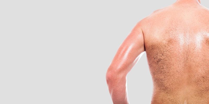 L'épilation laser réduit considérablement les poils épais, apportant un aspect soigné et propre