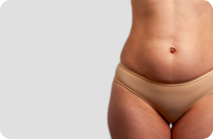 Bourrelets et formes disgracieuses sur le corps