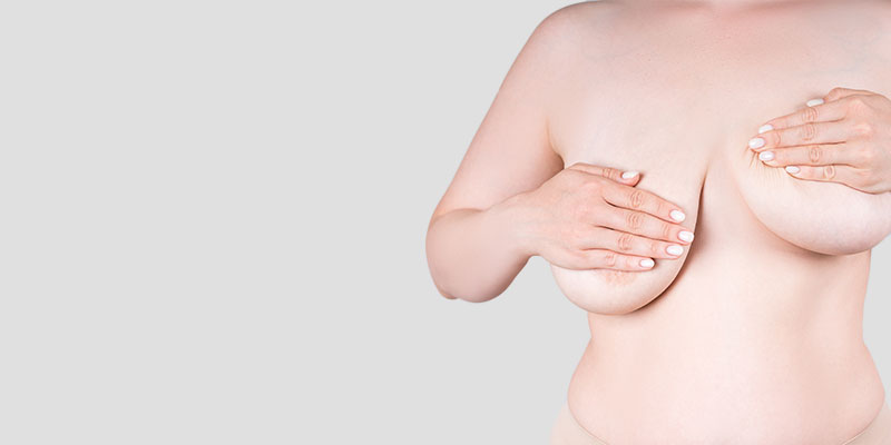 Les seins peuvent être armonisés par un lifting mammaire en cas d'asymétrie de la poitrine.