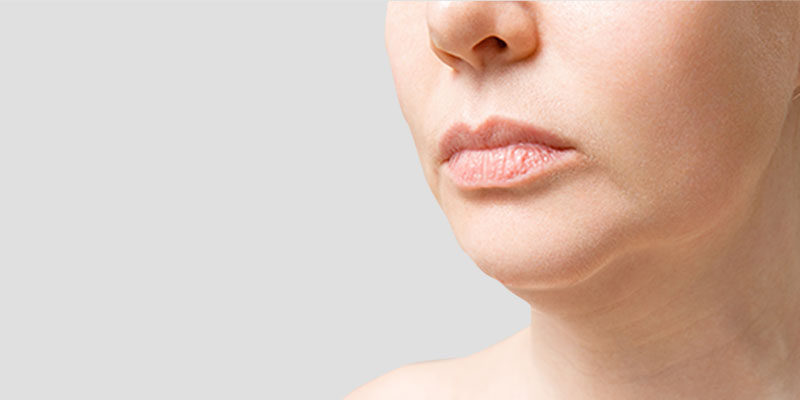 Solutions chirurgicales pour une correction durable