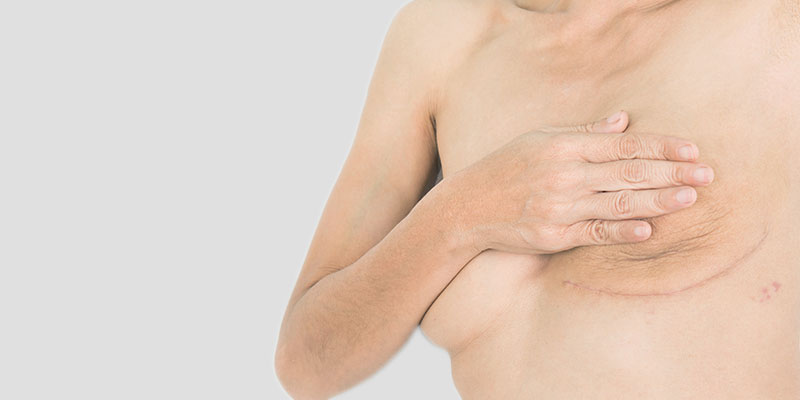 Reconstruction mammaire post-mastectomie